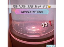チーズ(CHI’S)/30分3500円/毛穴洗浄で基本ケア