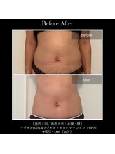 ル リアン(Le lien)/