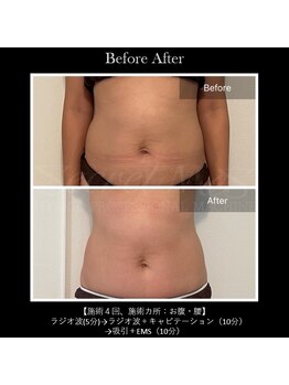 ル リアン(Le lien)/