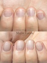 マリーロール 梅田店(Marie Laure)/自爪育成/深爪矯正/ネイルケア