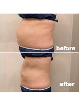 カブール 姫路店/キャビゼロ☆