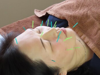 はやかわ鍼灸整骨院/初めての方に☆おてがる美容鍼☆