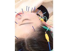 瑞 鍼灸院