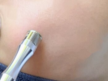 リマインド(Re:Mind)の写真/古い角質をオフして、栄養チャージ。肌土台から整える新習慣!!透明感とふっくら感のある素肌へ導きます。