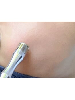 お肌をきれいにしたい