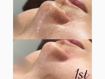 ファースト(1st)/