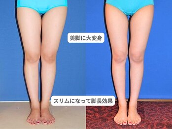 ピュアノア 垂水店/痩身ダイエット　神戸垂水明石