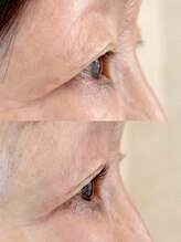 ダーム ド ローズ(Dame de rose)/【まぶたが上がるまつ毛パーマ】