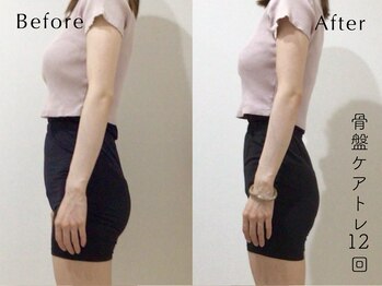 ペルビックハート(Pelvic Heart)/骨盤ケアトレ12回