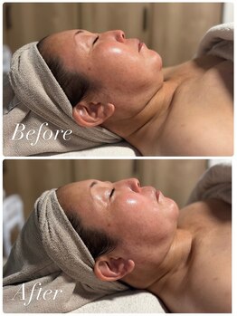 オリス(ORRIS)/ビフォーアフター