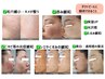 【本気の肌質改善】1ヶ月集中プログラム