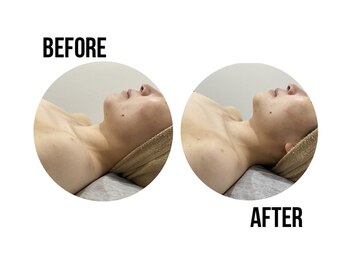 イードット(E.)/お肌のトーンアップにも♪