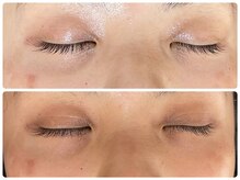 ラヴィ(Ravi)/目元ケア