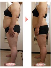 ピーキュア/3カ月ビフォーアフター