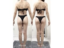 ナルシス/【痩身】4回でこの変化★
