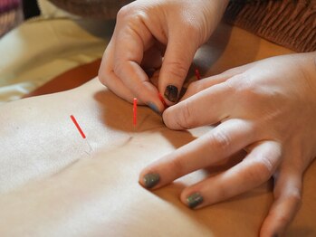 アディクト(Addict)/身体にも鍼