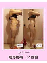 アコルデビューティー 恵比寿店(Acorde Beauty)/ビフォーアフター