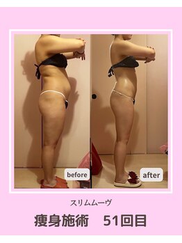 アコルデビューティー 恵比寿店(Acorde Beauty)/ビフォーアフター