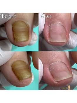 巻き爪補正店 那覇店/