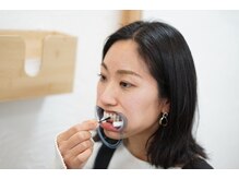 ジーツーホワイトニング 玉造(G2 whitening)/ホワイトニング用ジェルを塗布