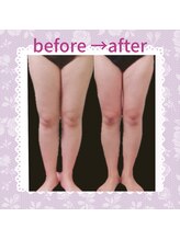 ビサイド(美side)/【痩身】