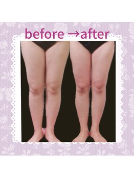 ビサイド(美side)/【痩身】