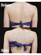 サンティエ(Santie)/ブライダルケア