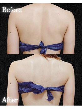 サンティエ(Santie)/ブライダルケア