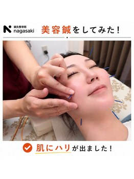 鍼灸整骨院ナガサキ(nagasaki)の写真/【美容鍼で肌が持つ力を呼び起こす】マッサージでは届かない皮膚の下にある真皮層を美容鍼で直接刺激◎