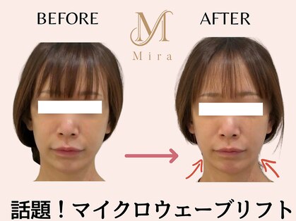 ミラ 札幌店(Mira)の写真
