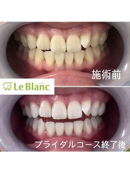 ルブラン 奈良店(Le Blanc)/ブライダルコース!