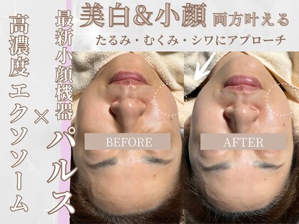 エクソ 吉祥寺(EXO)の写真