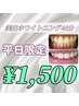 【平日ご来店限定】ホワイトニング40分　通常￥5980→￥1500