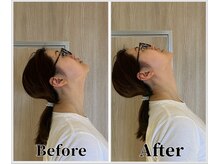 整体ラルース 中目黒(LALUZ)/30代 女性 ストレートネック改善