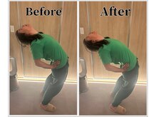 整体ラルース 中目黒(LALUZ)/50代　男性　腰痛、股関節の歪み