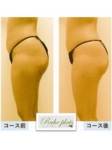 ルーエプラッツ 恵比寿(Ruhe plats)/コース結果写真【下半身】