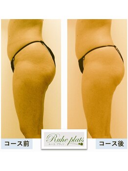 ルーエプラッツ 恵比寿(Ruhe plats)/コース結果写真【下半身】