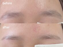 メイクマジック(Makemagic)/自然なストレートアーチ