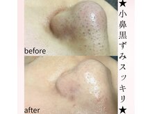 フルーヴ ルフレ(Fleuve Reflet)の雰囲気(【人気No.1】黒ずみ毛穴やザラザラ角栓は1回目でスッキリ☆)