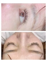 サロンドシャルム(Salon de charme)/特許技術メガマットボリューム