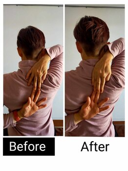 アース エンジェル整体院/ビフォアフ 肩甲骨はがし