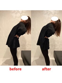 ナオル整体 福岡香椎院(NAORU整体)/30代女性施術事例【腰痛】
