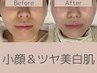【つるんと白玉肌◎剥離有ハーブピーリング】マッサージ＆パック付¥28000→