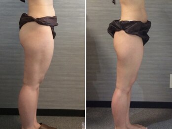 美容整体 ウェリナ 蟹江院/小顔矯正/骨盤矯正/美脚サロン