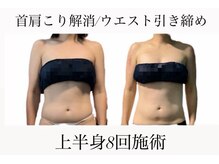 痩身革命 大宮店/ダイエットリンパマッサージ