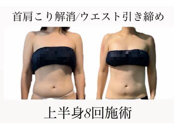 痩身革命 大宮店/ダイエットリンパマッサージ