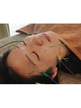 小顔になりたい