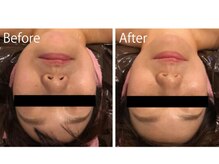 ライトウェーブ 松本村井本店/フォースカッター　フェイシャル