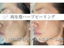 パールホワイトニングサロン 大和店の雰囲気（長年のお悩みのシミを改善大きい～小さいシミも改善/大和エステ）