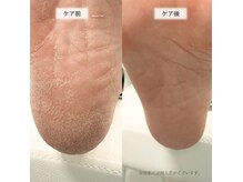 リケアネイル(Re:care nail)の雰囲気(気になる角質もスッキリ!手や足の皮膚のごわつきもプルプルに◎)
